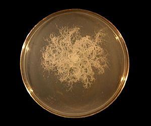 The garden microbe with a sense of touch