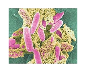 UCSF Team Develops Logic Gates To Program Bacteria As Computers