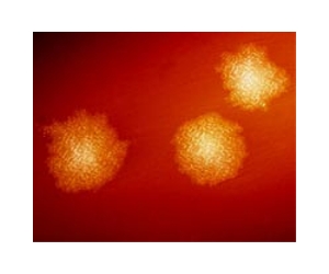 China reports first cases of South Asian superbug