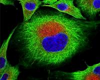 New tool advances investigations of disease outbreaks