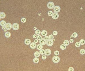 Scientists track evolution and spread of deadly fungus