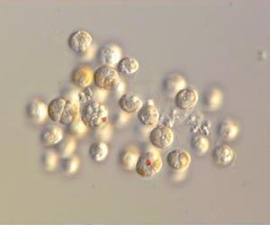Anti-inflammatory drugs may improve survival from severe malaria