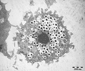 Study of giant viruses shakes up tree of life
