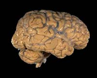 Human Brain Filing System Uncovered