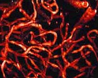 Ultrafast Lasers Slice Up High-Quality Brain Tissue Images