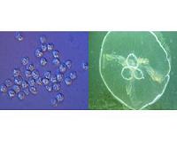 Researchers sequence genomes of parasite that is actually a 'micro jellyfish'