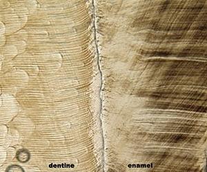 First Molars Provide Insight Into Evolution Of Great Apes