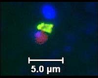 Scientists Discover New Life Forms In The Arctic Ocean