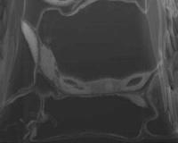 Viewing plant cells in 3-D (no glasses required)