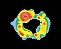 Supernova Lights Up Expanding Ring