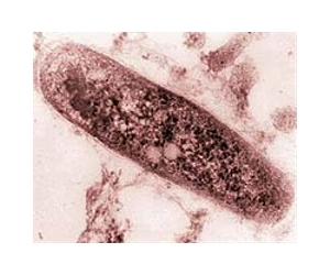 US donates tuberculosis facility to Nigeria