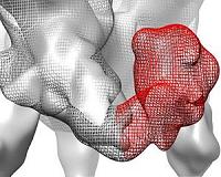 Advances in electron microscopy reveal secrets of HIV